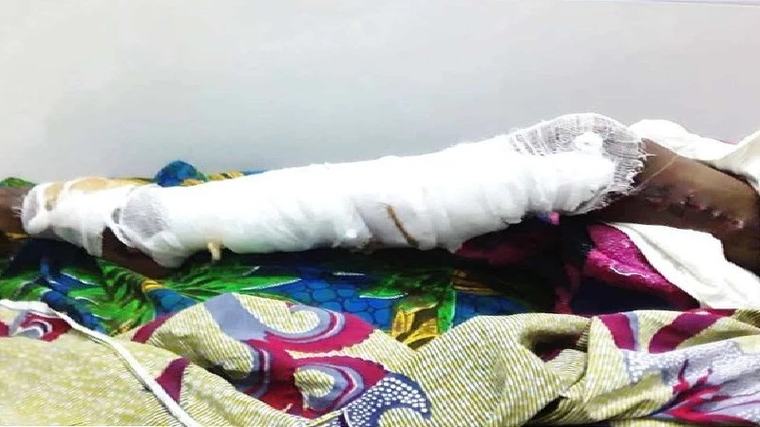 Mwanafunzi aliyeng’atwa na nyoka atoka hospitalini